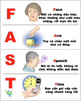 Dấu hiệu nhận biết đột quỵ Dấu hiệu nhận biết đột quỵ