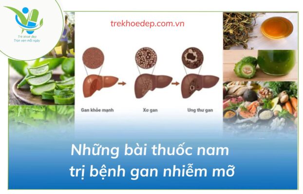 Những bài thuốc nam trị bệnh gan nhiễm mỡ