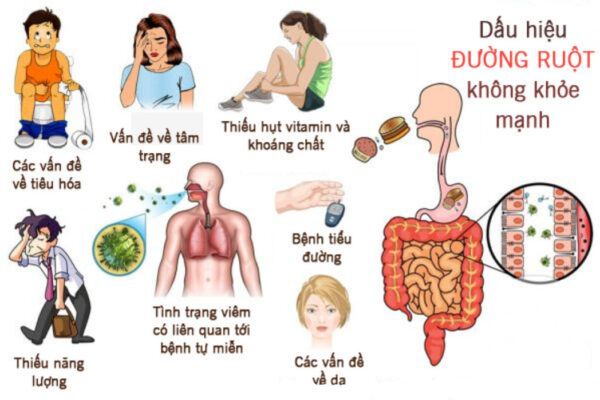 Dấu hiệu của đường ruột không khoẻ mạnh